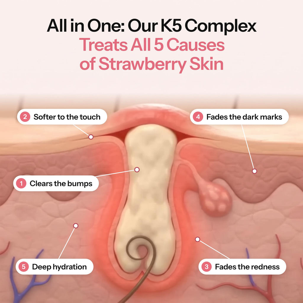 MIMOYA K5 Complex treats all 5 causes of strawberry skin: clears the bumps, softer to the touch, fades the redness and dark marks, deep hydration